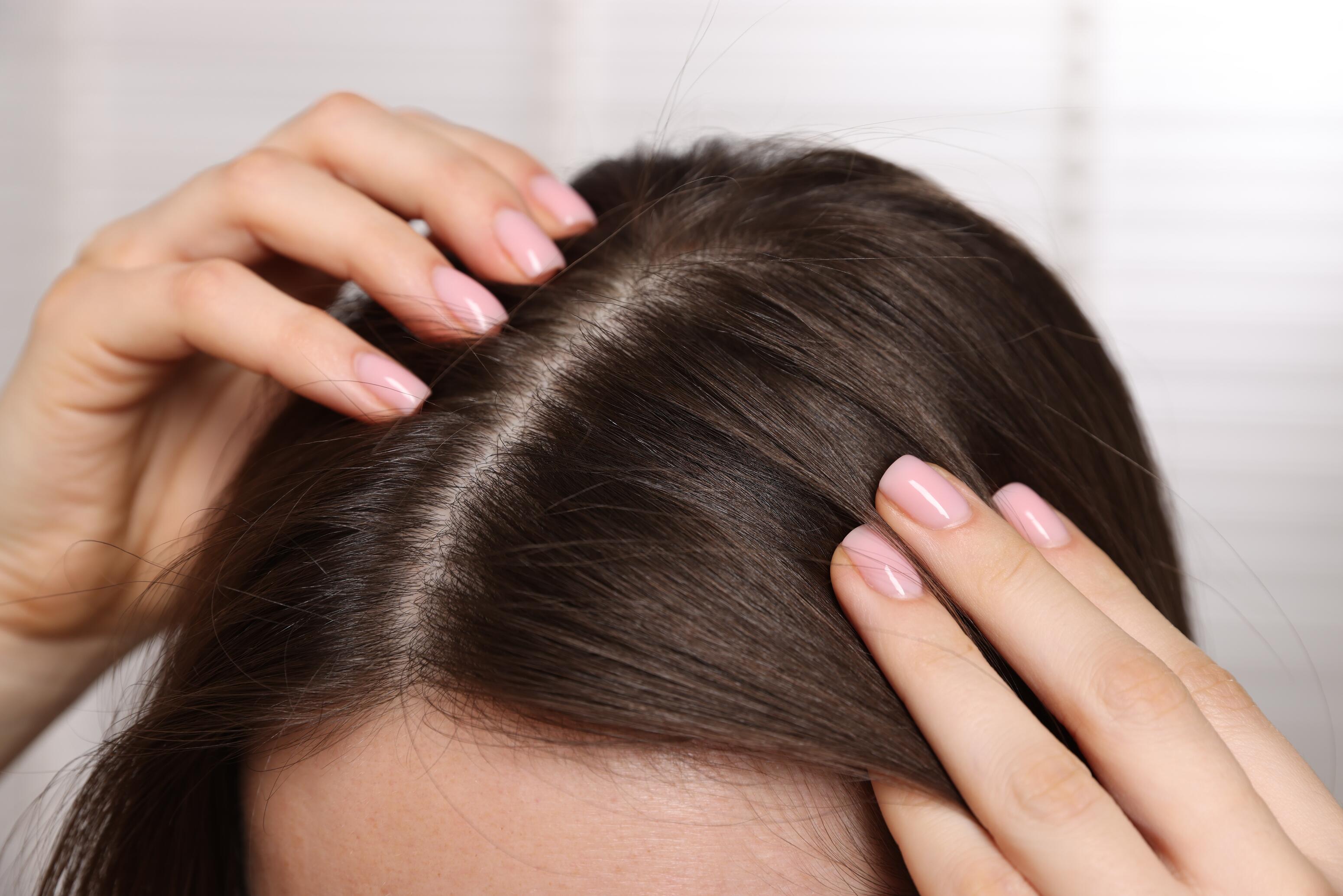 Traitements contre la perte de cheveux chez la femme